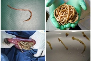 which parasites can live in the human intestine