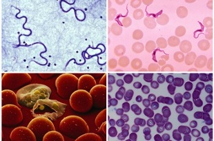which parasites may be in human blood